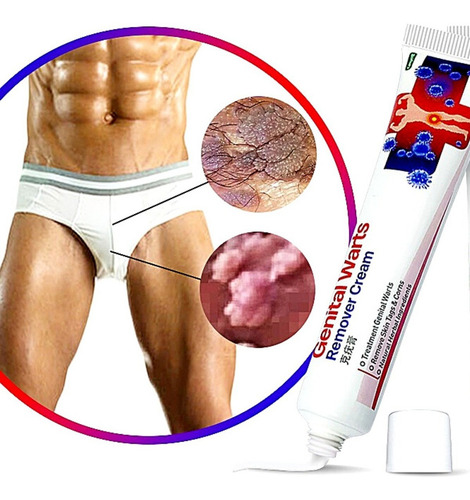 1x Pomada Tira Verruga Hpv Coceiras Manchas Fungos Neutra