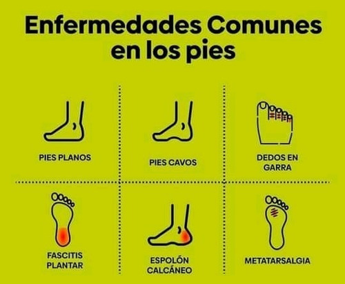 Imagen 3 de 5 de Plantillas Zapatos Fascitis Morton Espolon Pie Plano Cavo