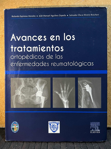 Tratamientos Ortopedicos De Las Enfermedades Reumatologicas.