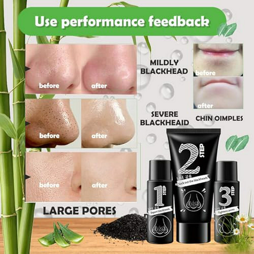 Kit Mascarilla Facial Purificante De Carbón, Control De Gras