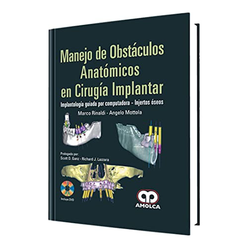 Libro Manejo De Obstáculos Anatómicos En Cirugía Implantar D