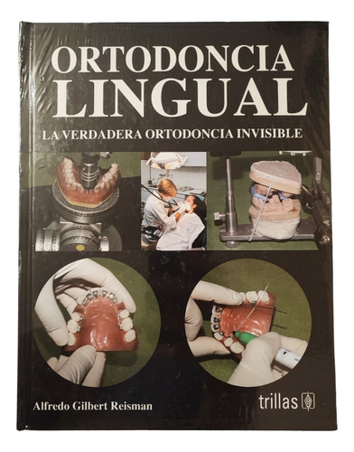 Ortodoncia Lingual: La Verdadera Ortodoncia Invisible Nuevo