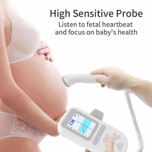 Monitor Doppler Fetal Recargable Con Gráfica De Curva.