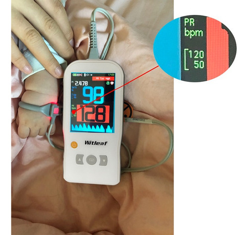 Oximetro Pulsometro Portatil Sonda Neonatal Witleaf Bl