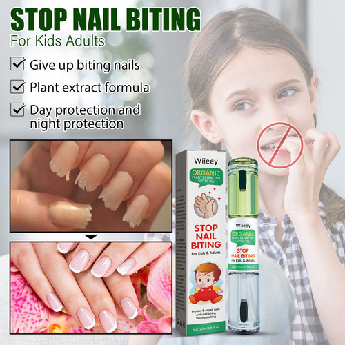 Tratamiento Para Morderse Las Uñas Para Niños Y Dejar De Chu