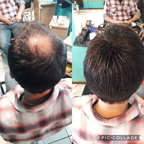 Imagen 4 de 4 de Scalp Protector Thick Walker Para Prótesis Capilar. Usa