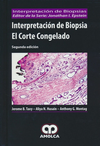 Interpretacion De Biopsia - Taxy, Jerome