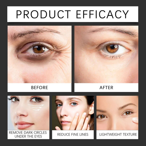 La Crema Hidratante Para Ojos Hidrata La Piel Alrededor De L