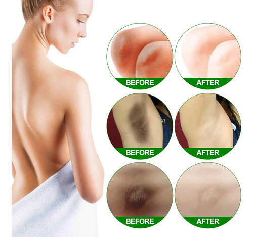 Crema Blanqueadora Para Blanquear Axis Y Whiteni-