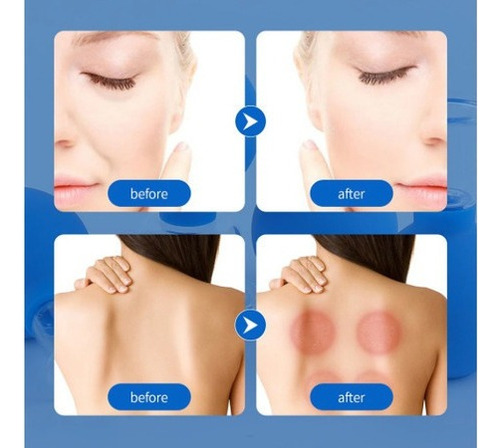 R Bola Ventosa De Pvc Para Masaje Facial De 4 Piezas