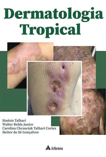 Livro Dermatologia Tropical, 1ª Edição 2022