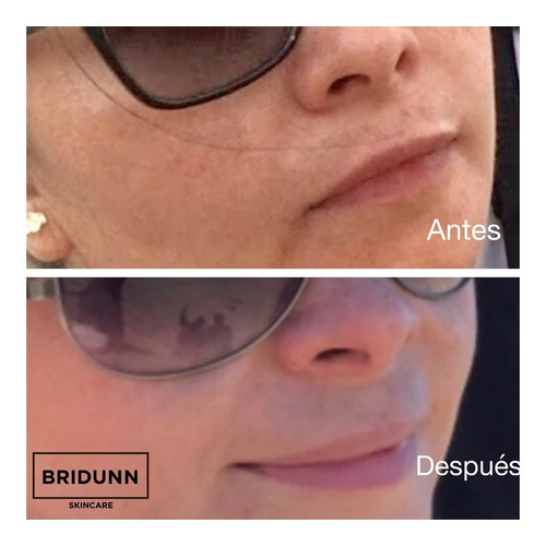 Imagen 2 de 9 de Crema Despigmentante Quita Manchas Y Paño Bridunn Skincare