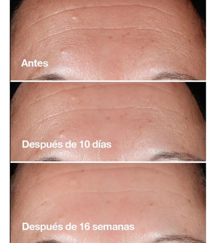 Clinique Set Smart Routine