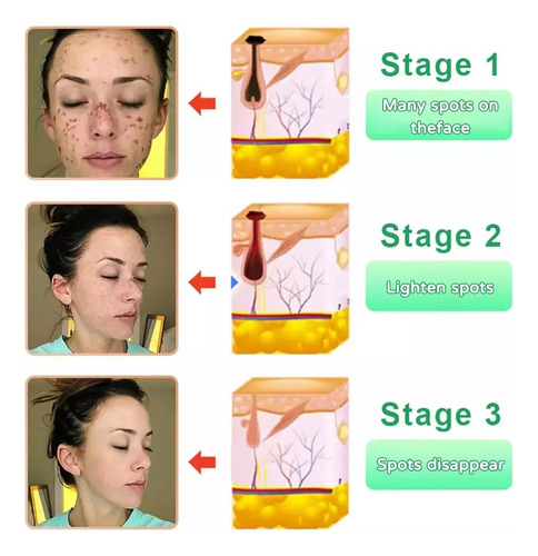 Quarxeri Purificante Exfoliante, Gel Exfoliante Avanzado 2 P