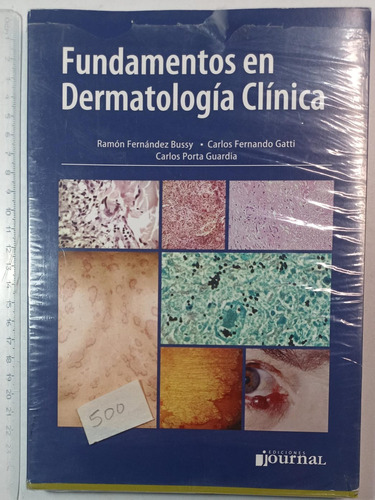 Fundamentos En Dermatología Clínica