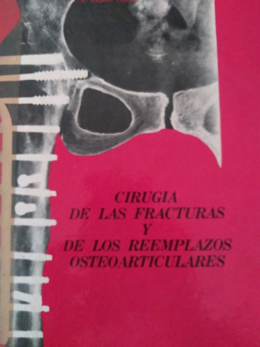 Cirugía De Las Fracturas Y De Los Reemplazos Osteoarticulare