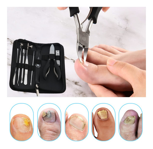 Upgraded 6pcs/set Ingrown Toenail Tools Kit, Premium Nail Tr
