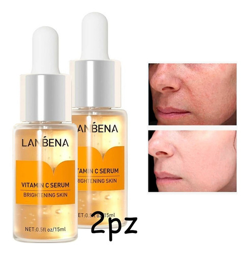 Kit 2pzs Serum Lanbena Vitamina C Remueve Pecas Manchas Tipo de piel Normal