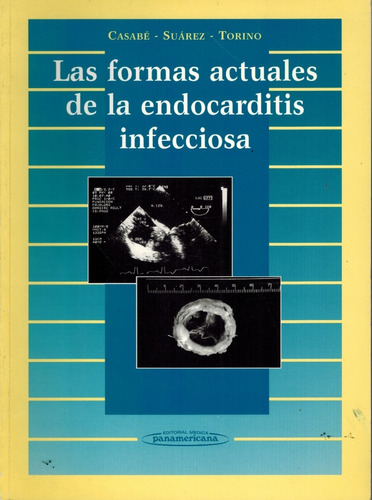  Las Formas Actuales De La Endocarditis Infecciosa - Casabé