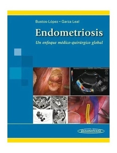 Endometriosis Un Enfoque Medico Quirurgico Global Nuevo!