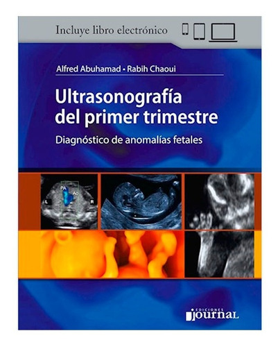 Ultrasonografía Del Primer Trimestre - Abuhamad - Cahoui