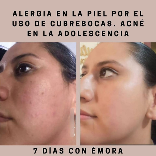 Imagen 7 de 7 de Emora, Esencia Tonificadora - g a $8846