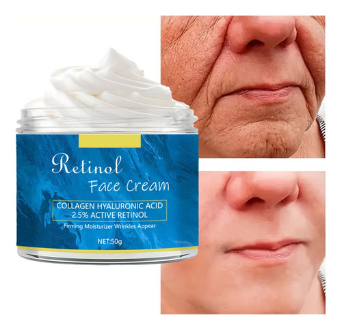 B Retinol 50g. Hidratante, Hidratante, Refrescante E N 0021
