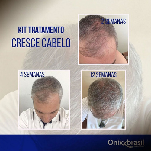 Condicionador Cresce Cabelo 300ml Fortalece Ação Anti Queda