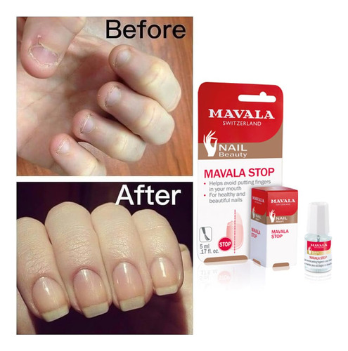 Tratamiento De Esmalte De Uñas Mavala Stop Deterrent De 5 Ml