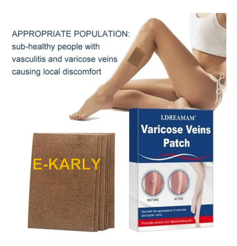 35 Parches Para Aliviar El Dolor En Personas Con Varices