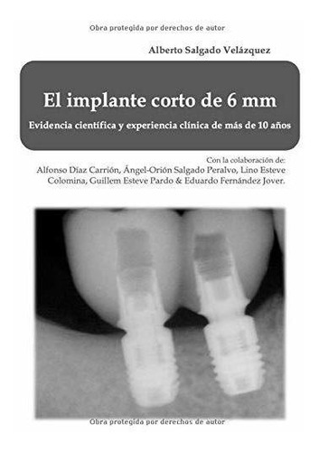 Libro El Implante Corto De 6 Mm: Evidencia Científica Lcm5