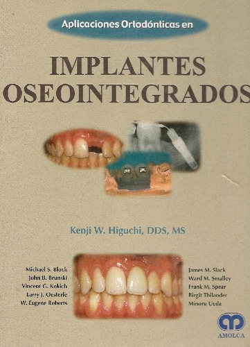 Libro Aplicaciones Ortodónticas En Implantes Oseosintegrados