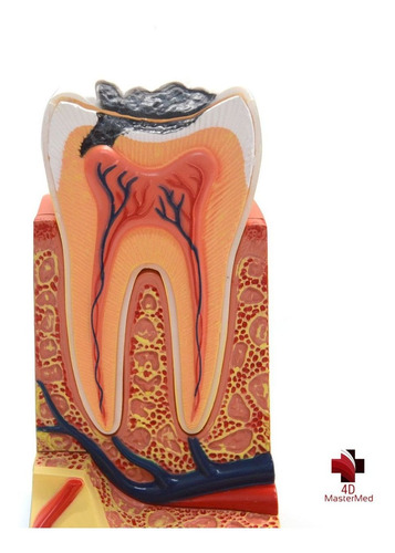 Modelo Do Corpo Humano - Dente Molar - 4d Master