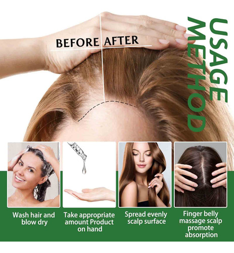 Esencia De Aceite Para El Cabello De Romero,aceite Esencial
