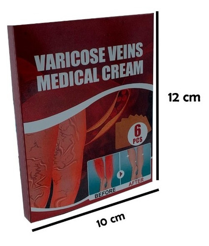 6 Parches Para Aliviar El Dolor De Las Varicosas Varices