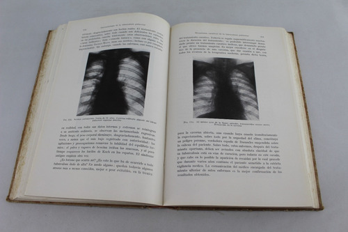 L7052 Diagnostico Y Tratamiento De La Tuberculosis Pulmonar (Usado)