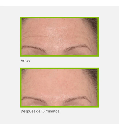 Murad Tratamiento Instantáneo Localizado para las Arrugas 15ml para Todo Tipo de Piel
