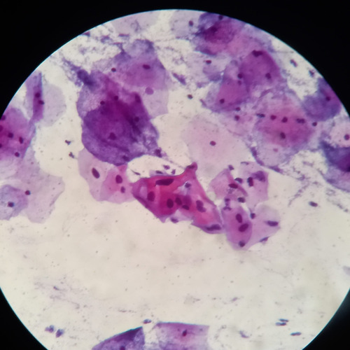 Imagen 4 de 6 de Harris Hematoxilin_a