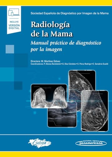 Libro Radiología De La Mama  De María Martínez Gálvez Ed: 1