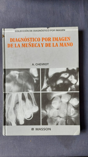 Diagnostico Por Imagen De La Muñeca Y De La Mano - Ed Masson