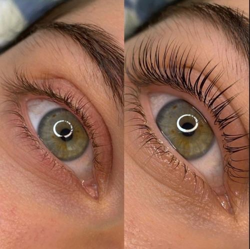 Imagen 3 de 4 de Estetica Afrodita Premium