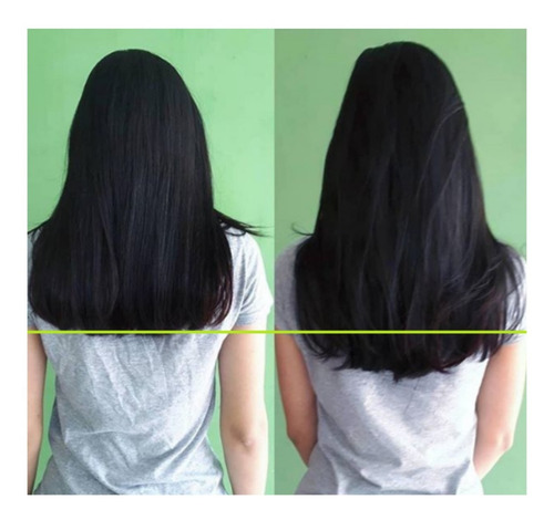 Imagem 3 de 7 de Cresce Cabelo - Produto Para Crescer Cabelo Em 15 Dias