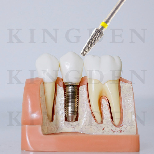 Fresón De Carburo Dental H.p. #106 Encías Artificiales