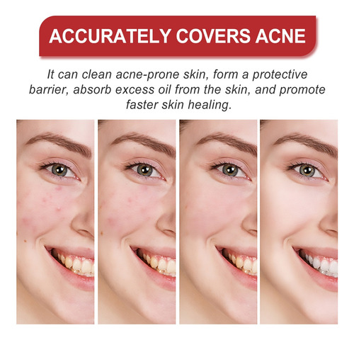 2 Pacotes De Adesivos Faciais Anti-acne, Suaves