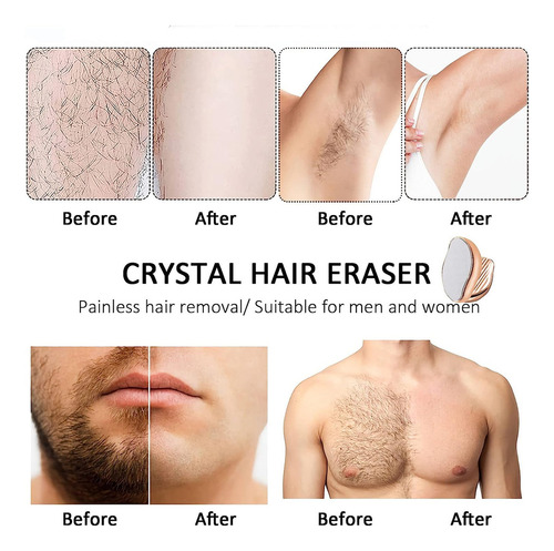 Borrador De Cabello De Cristal, Removedor De Peinado De Cris