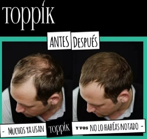Imagen 9 de 9 de Pack Toppik Microfibras De Queratina + Aplicador Difusor