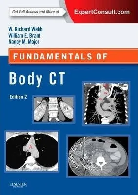 Fundamentals Of Body Ct - W.richard Webb