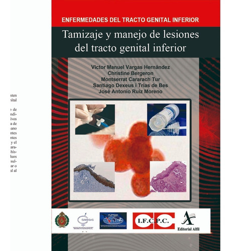 Tamizaje y manejo de lesiones del tracto genital inferior, de Vargas , Víctor Manuel. Editorial Alfil, tapa blanda en español, 2020