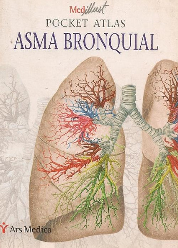Libro Asma Bronquial Pocket Atlas De Ars Medica
