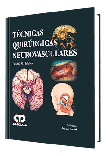 Técnicas Quirúrgicas Neurovasculares. Libro De Medicina.